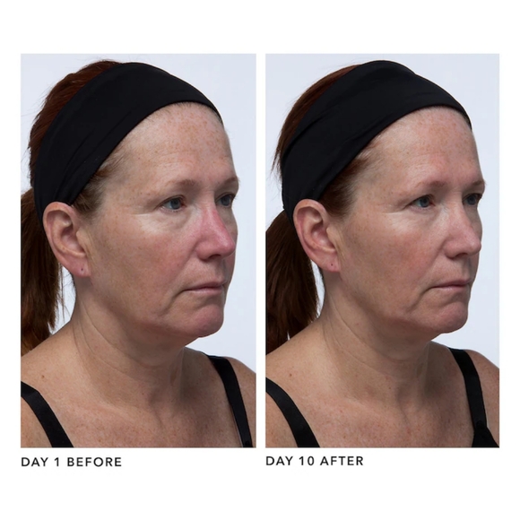 ALGENIST GENIUS Collagen Anti-Aging Calming Relief - Picture 2 of 7